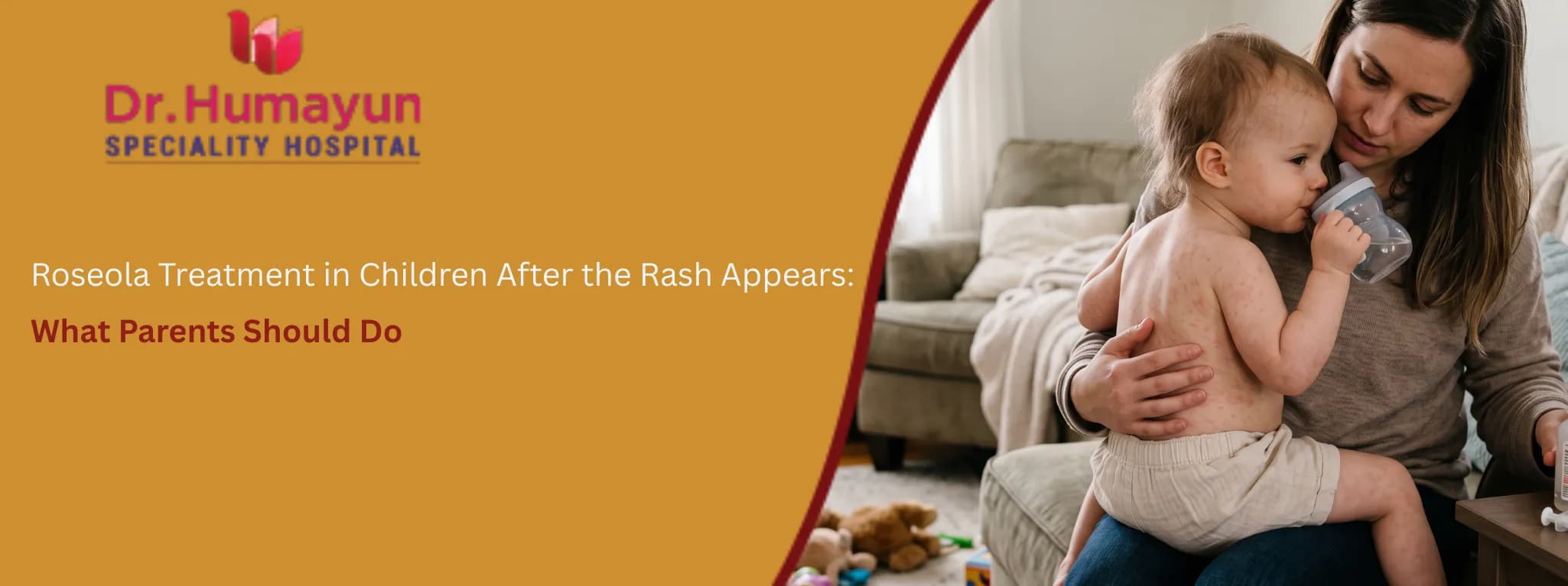 Roseola Treatment in Children After the Rash Appears: What Parents Should Do, Humayun Hospital chennai