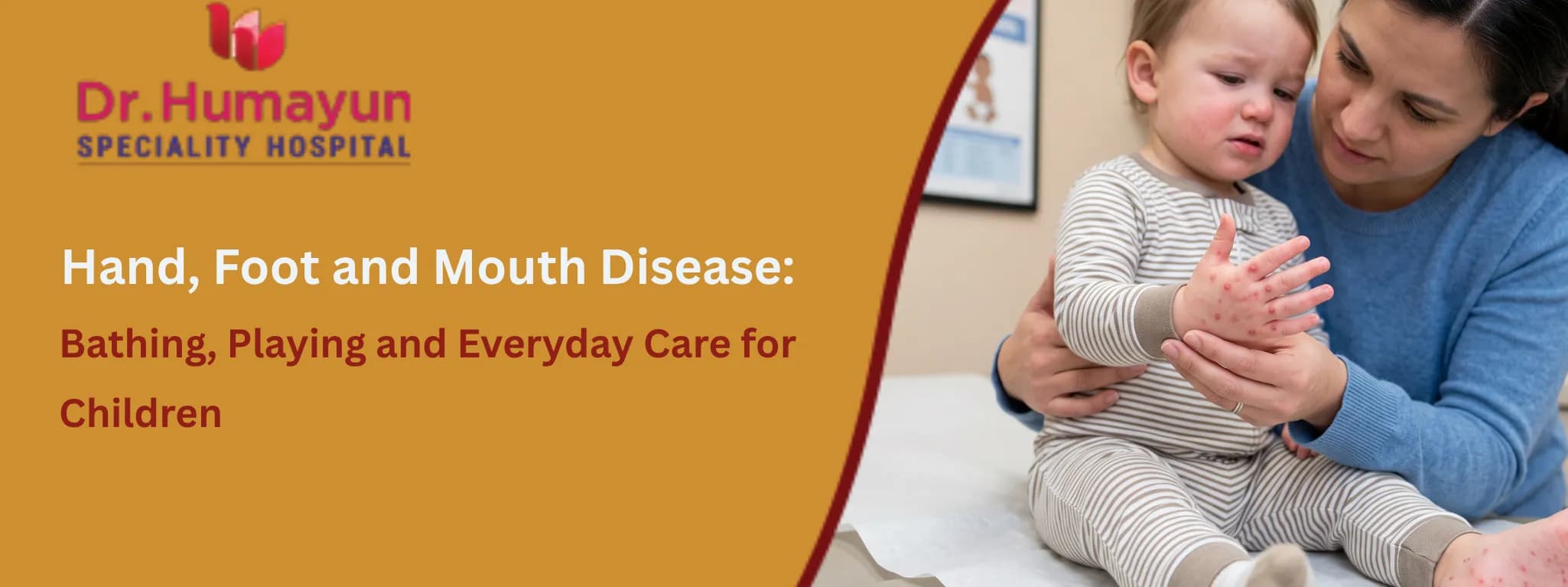 Hand, Foot and Mouth Disease: Bathing, Playing and Everyday Care for Children, humayun hospital, chennai