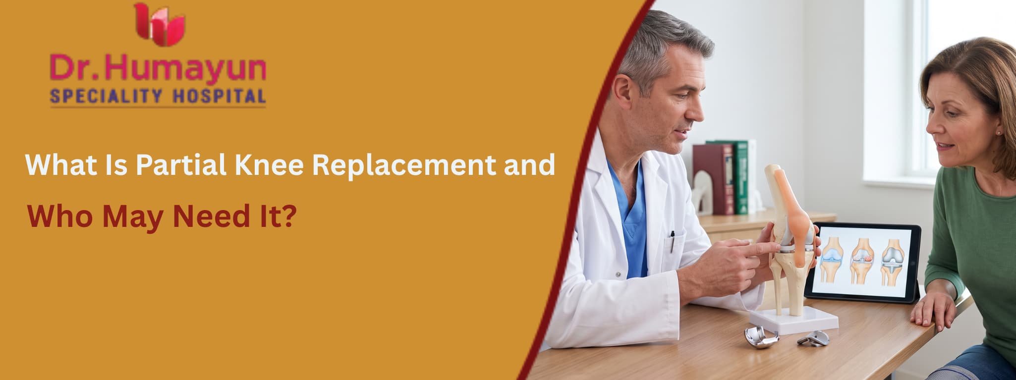 What Is Partial Knee Replacement and Who May Need It?, humayun hospital, chennai