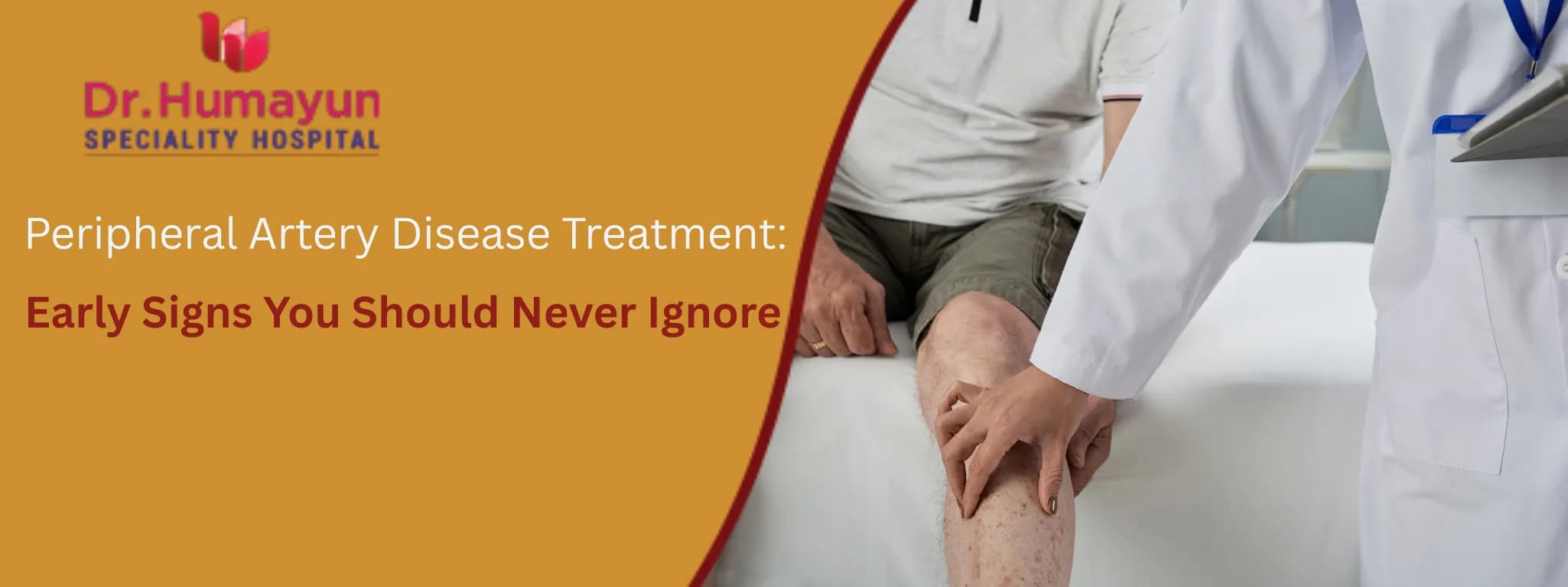 Peripheral Artery Disease Treatment: Early Signs You Should Never Ignore, Humayun hospital, chennai