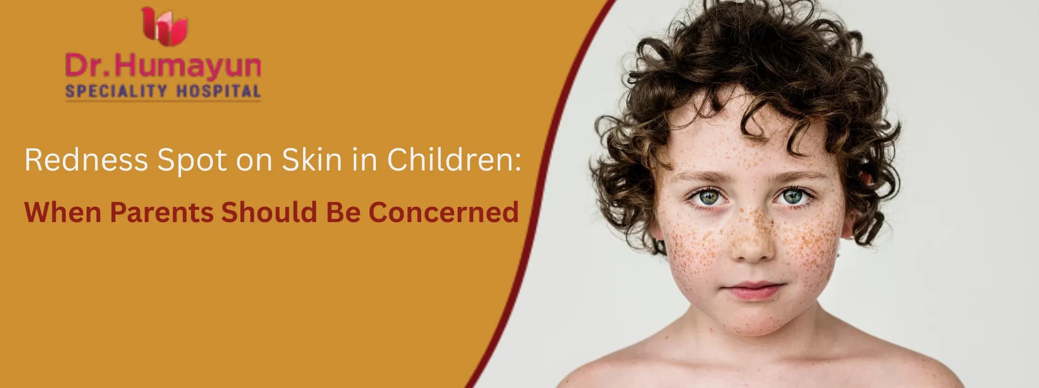 Redness Spot on Skin in Children: When Parents Should Be Concerned