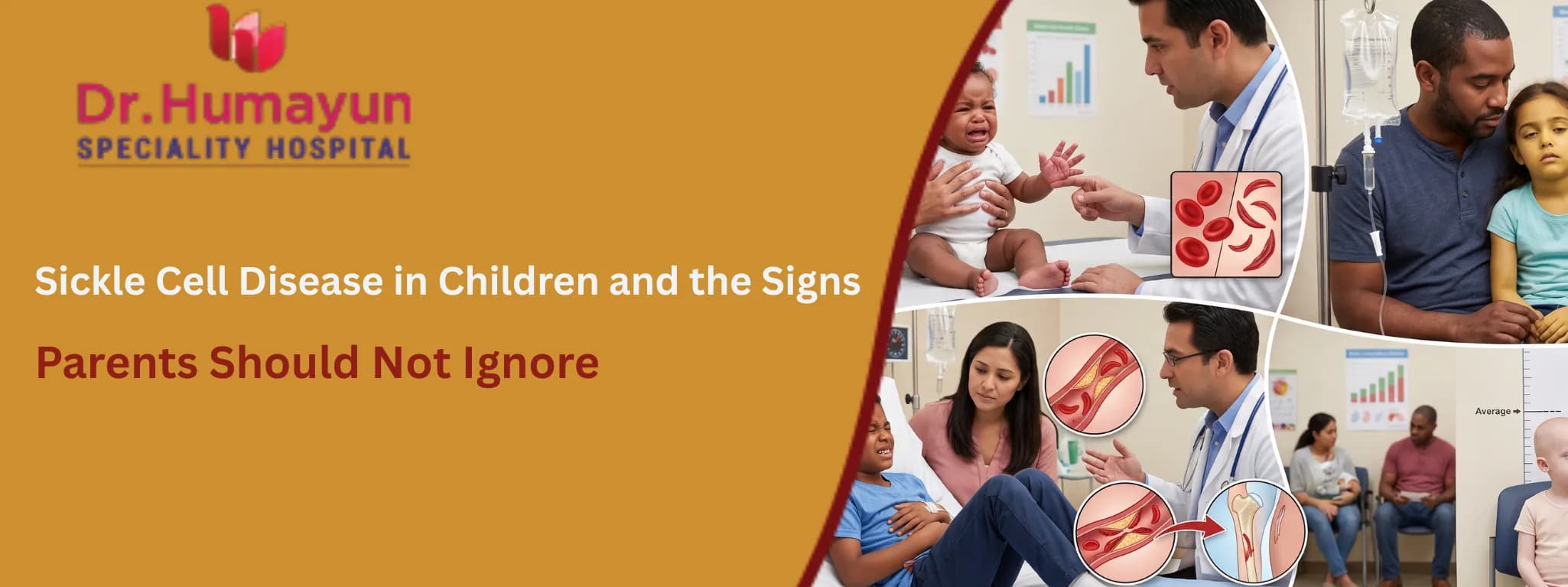 Sickle Cell Disease in Children and the Signs Parents Should Not Ignore, Humayun hospital, chennai
