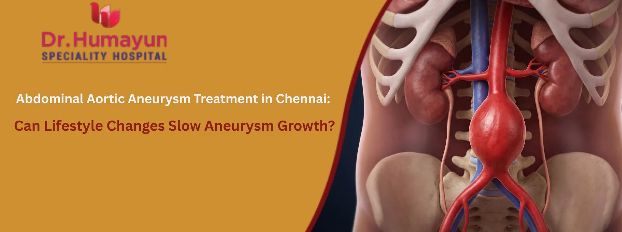 Abdominal Aortic Aneurysm Treatment in Chennai: Can Lifestyle Changes Slow Aneurysm Growth?, humayun hospital chennai