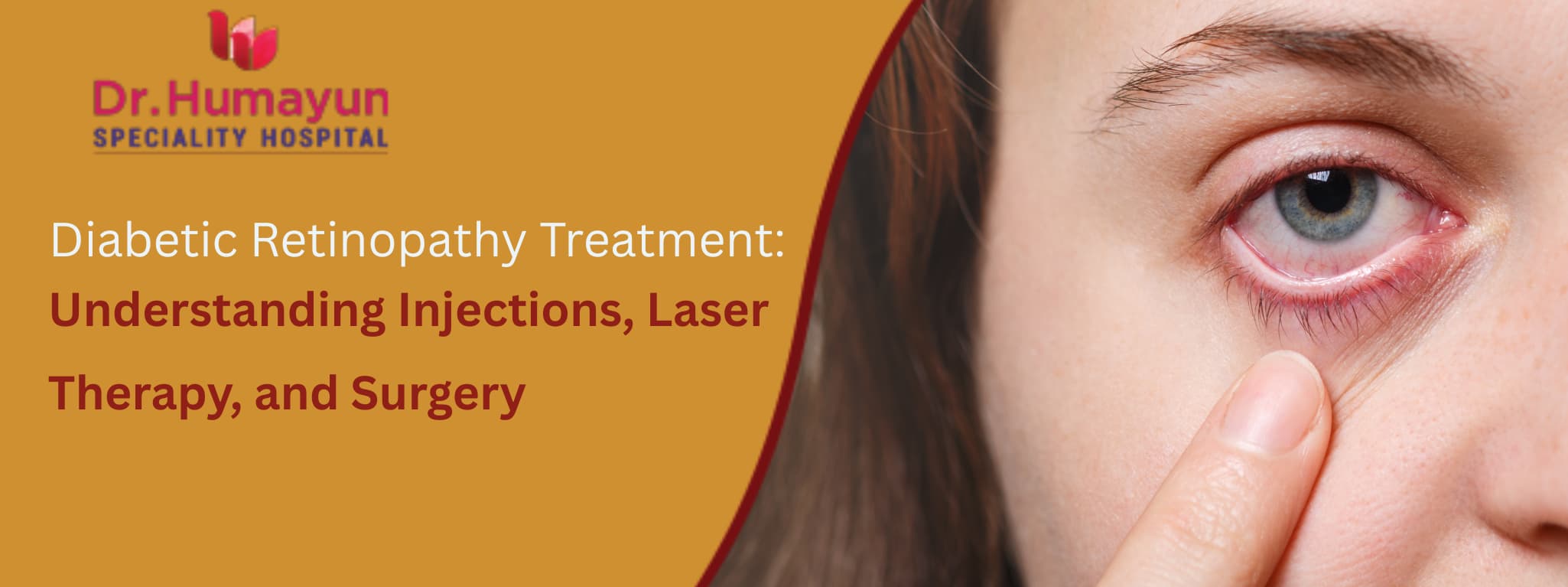 Diabetic Retinopathy Treatment: Understanding Injections, Laser Therapy, and Surgery, Humayun hospital, chennai