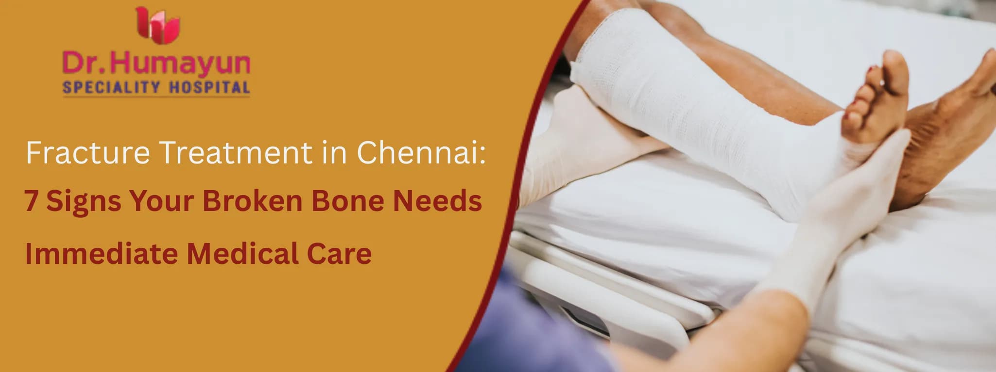 Fracture Treatment in Chennai: 7 Signs Your Broken Bone Needs Immediate Medical Care, Humayun Hospital, Chennai